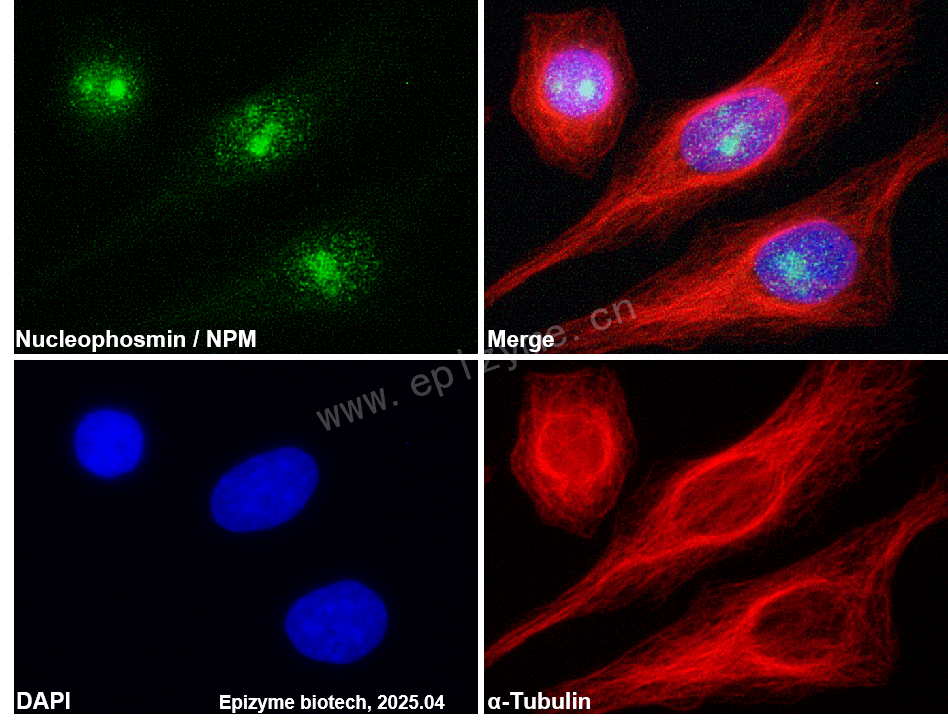 Anti-Nucleophosmin Rabbit mAb [47K12K10]