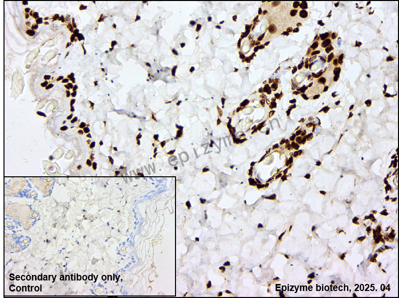 Anti-Nucleophosmin Rabbit mAb [47K12K10]