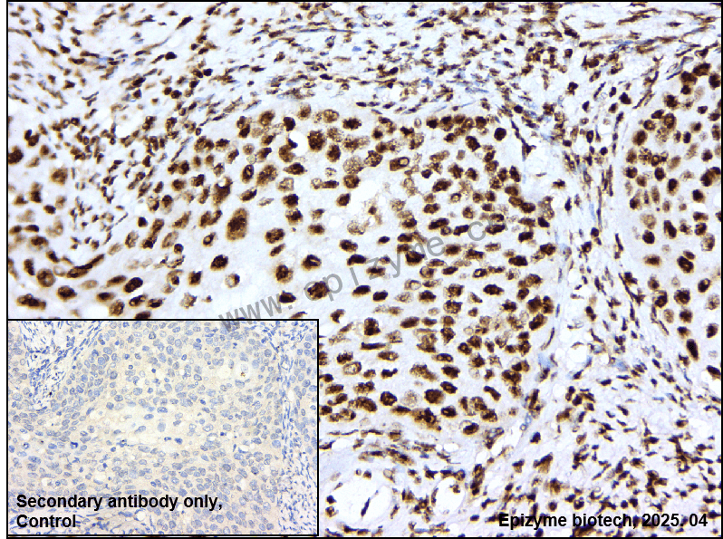 Anti-Nucleophosmin Rabbit mAb [47K12K10]