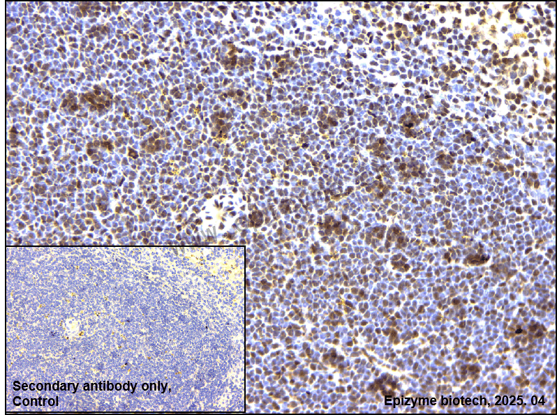 Anti-Nucleophosmin Rabbit mAb [47K12K10]