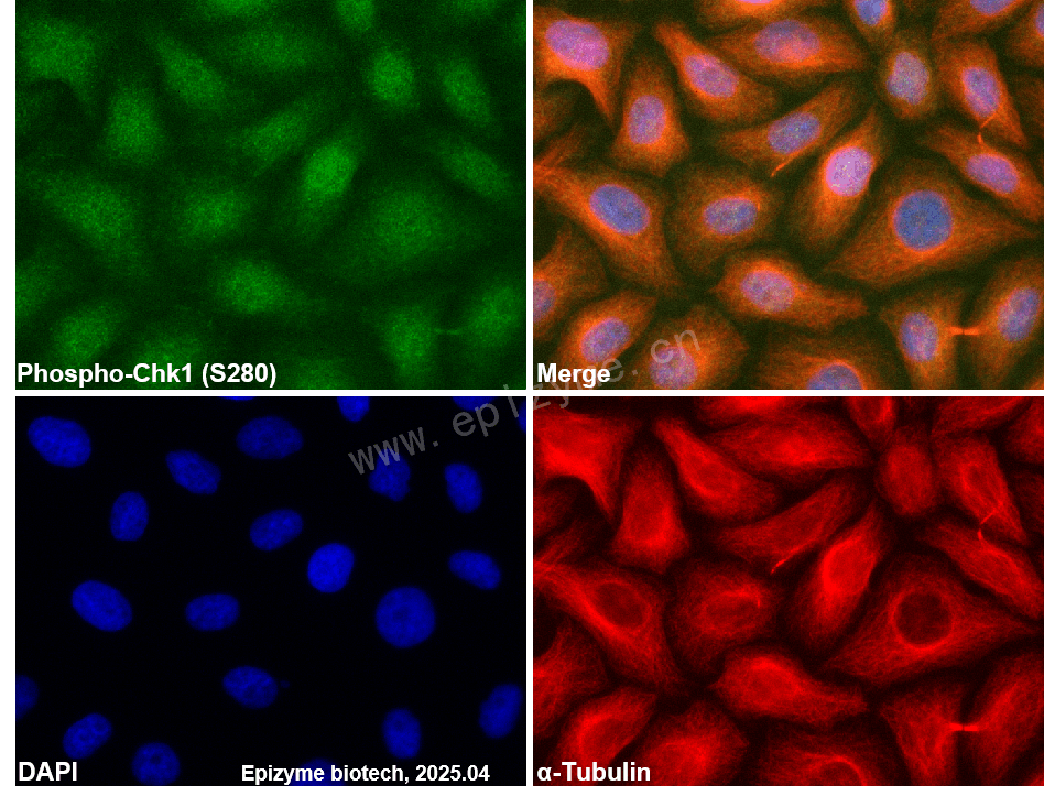 Anti-Phospho-Chk1 (Ser280) Rabbit mAb [30I72T48]