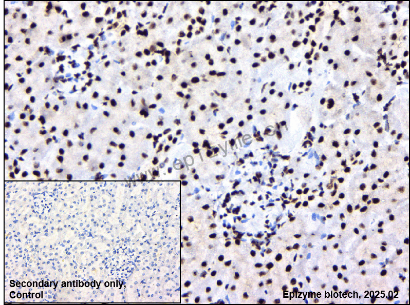 Anti-Phospho-c-Jun (Ser73)/JunD (Ser100) Rabbit mAb [15B01H06]