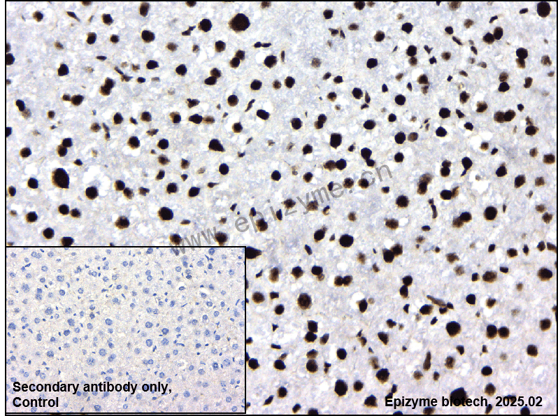 Anti-Phospho-c-Jun (Ser73)/JunD (Ser100) Rabbit mAb [15B01H06]