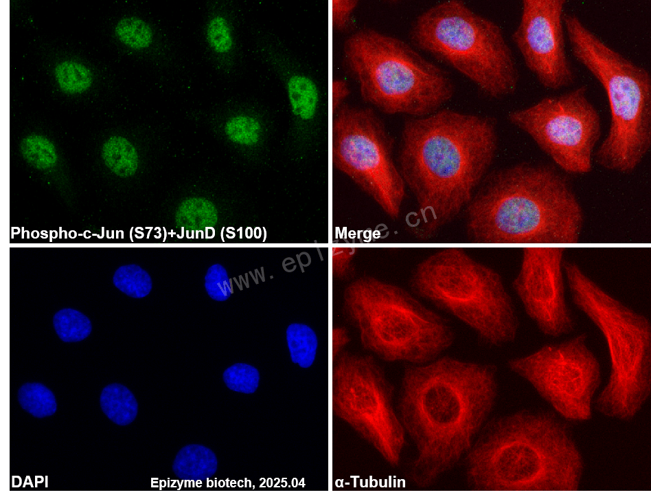 Anti-Phospho-c-Jun (Ser73)/JunD (Ser100) Rabbit mAb [15B01H06]