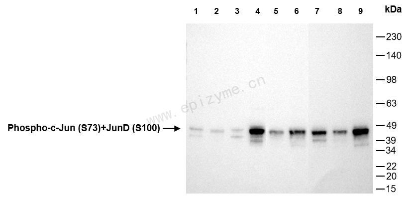 Anti-Phospho-c-Jun (Ser73)/JunD (Ser100) Rabbit mAb [15B01H06]