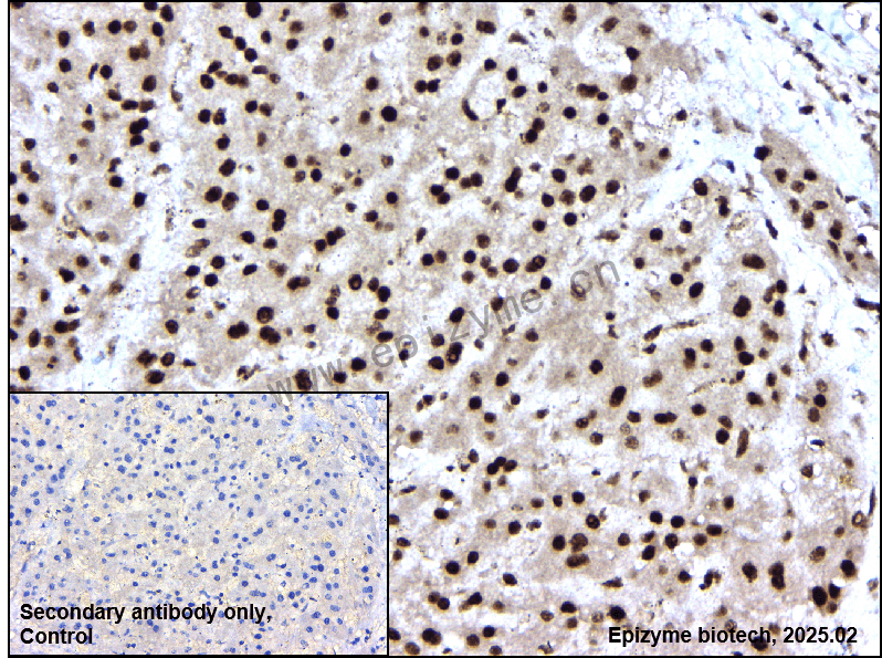 Anti-Phospho-DNA PKcs (Ser2056) Rabbit mAb [75D61M18]