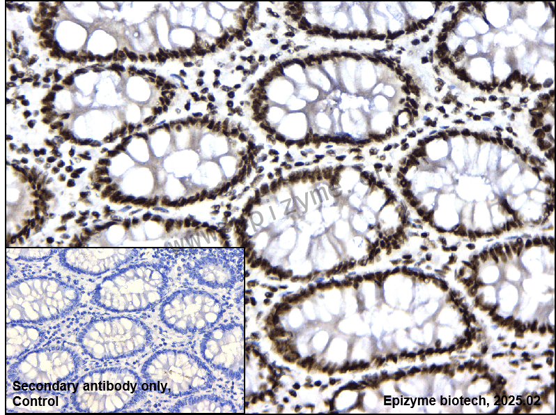 Anti-Phospho-DNA PKcs (Ser2056) Rabbit mAb [75D61M18]