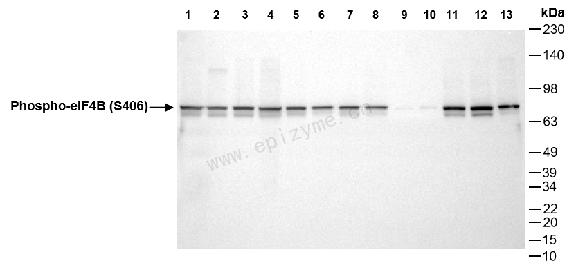 Anti-Phospho-eIF4B (Ser406) Rabbit mAb [67Q83F64]