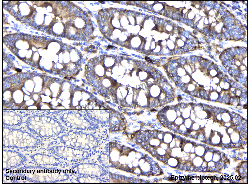 Anti-Phospho-eIF4B (Ser406) Rabbit mAb [67Q83F64]