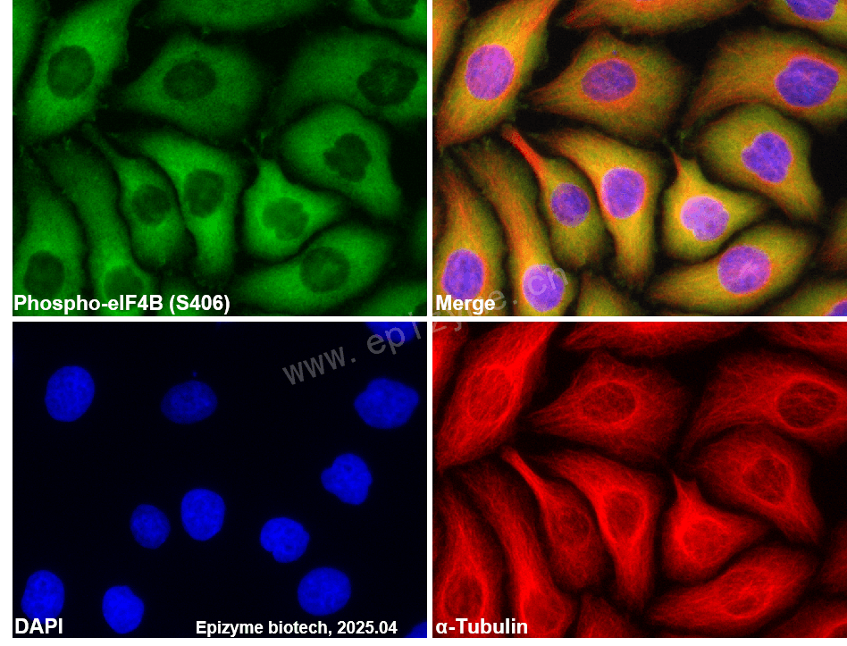 Anti-Phospho-eIF4B (Ser406) Rabbit mAb [67Q83F64]