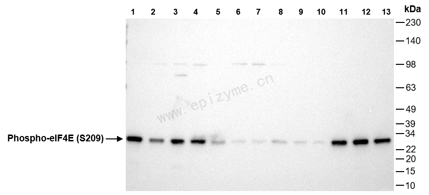 Anti-Phospho-eIF4E (Ser209) Rabbit mAb [56N47C29]