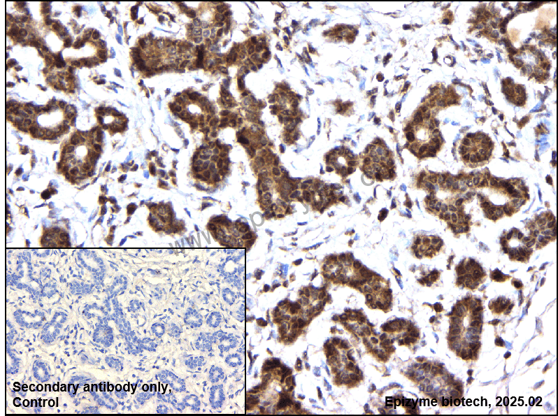 Anti-Phospho-eIF4E (Ser209) Rabbit mAb [56N47C29]