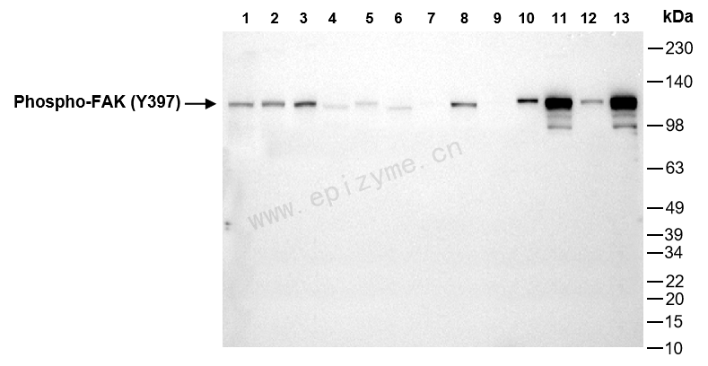 Anti-Phospho-FAK (Tyr397) Rabbit mAb [79E12A96]