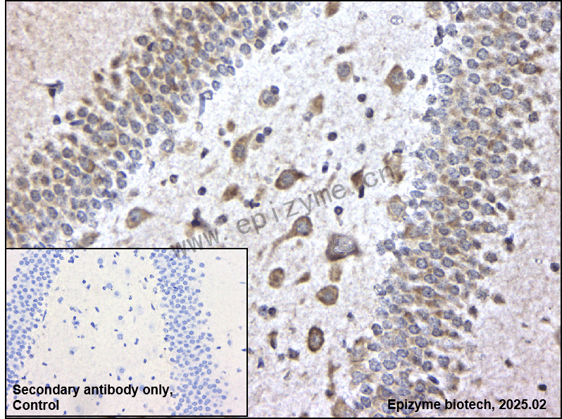 Anti-Phospho-FAK (Tyr397) Rabbit mAb [79E12A96]