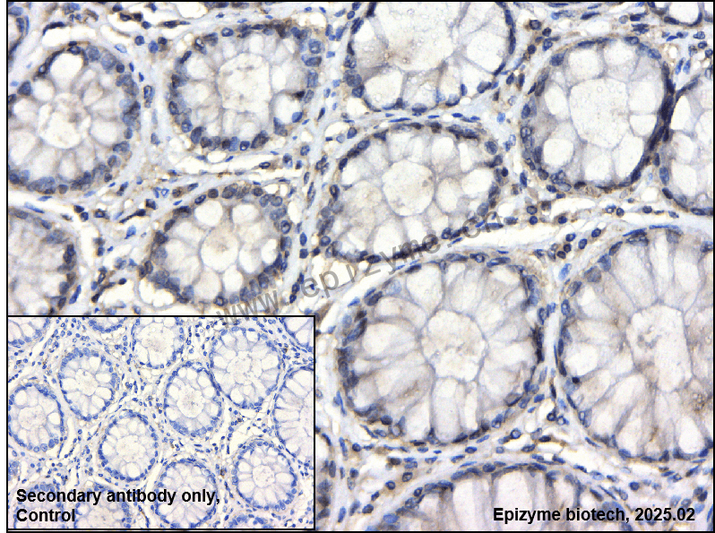 Anti-Phospho-FAK (Tyr397) Rabbit mAb [79E12A96]