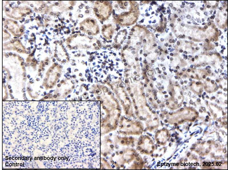 Anti-Phospho-FAK (Tyr397) Rabbit mAb [79E12A96]