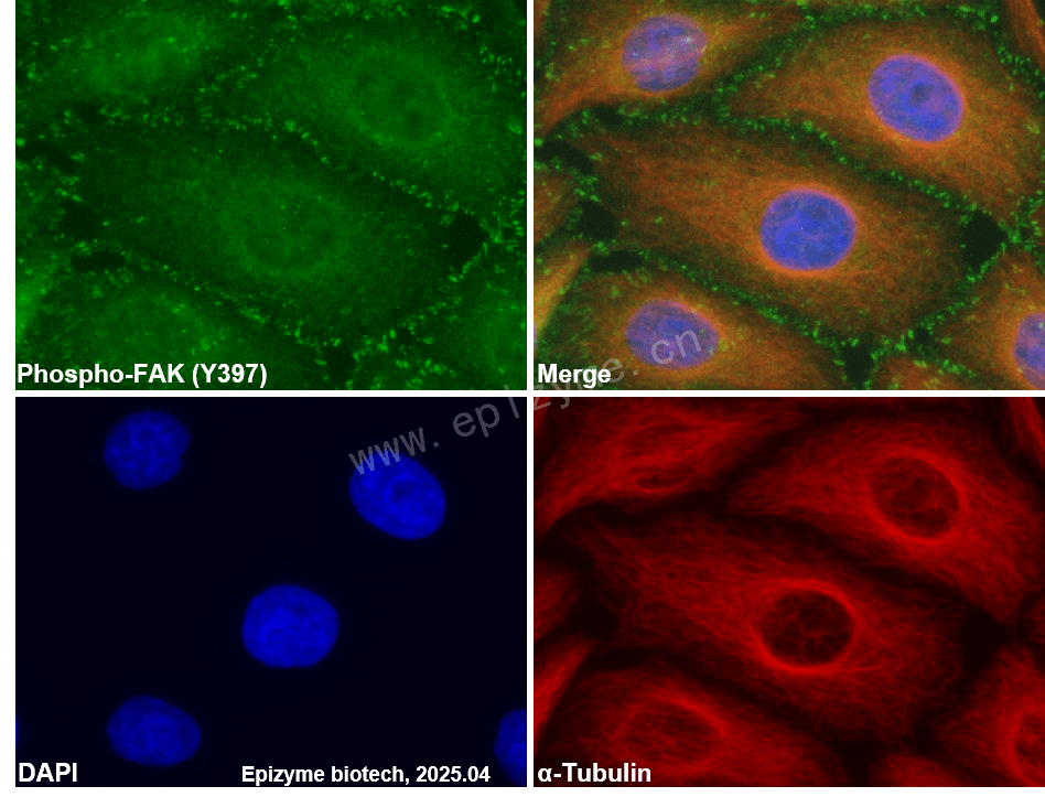 Anti-Phospho-FAK (Tyr397) Rabbit mAb [79E12A96]