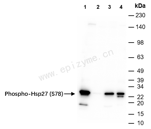 Anti-Phospho-Hsp27 (Ser78) Rabbit mAb [22I81N46]
