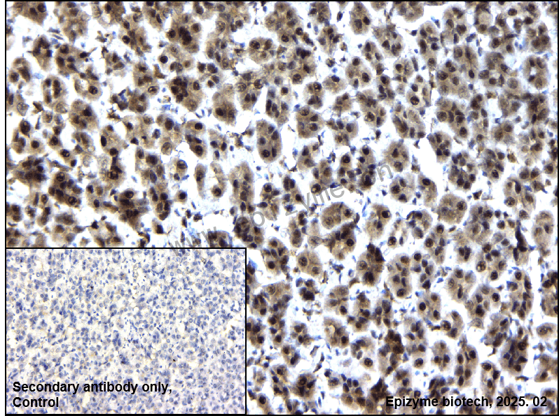 Anti-Phospho-Hsp27 (Ser78) Rabbit mAb [22I81N46]