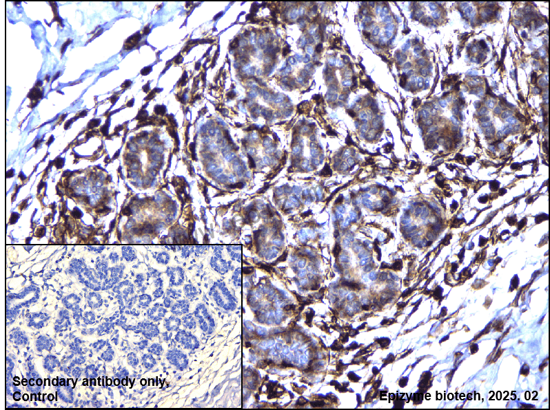 Anti-Phospho-Hsp27 (Ser78) Rabbit mAb [22I81N46]