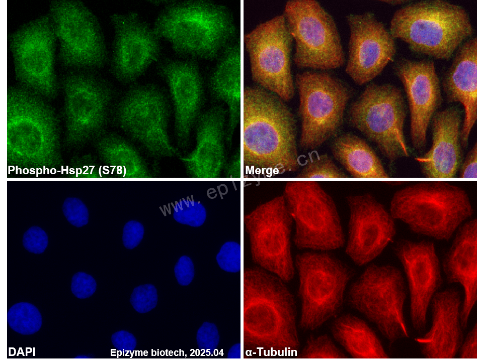 Anti-Phospho-Hsp27 (Ser78) Rabbit mAb [22I81N46]