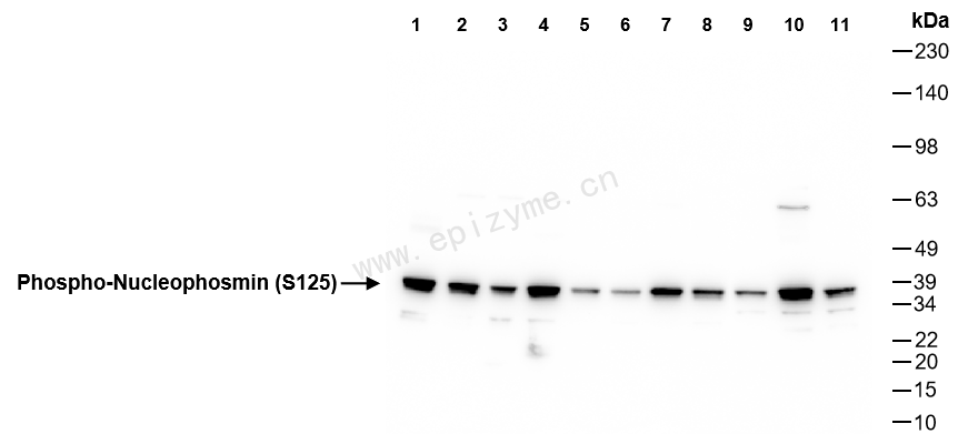 Anti-Phospho-Nucleophosmin (Ser125) Rabbit mAb [34A73C93]