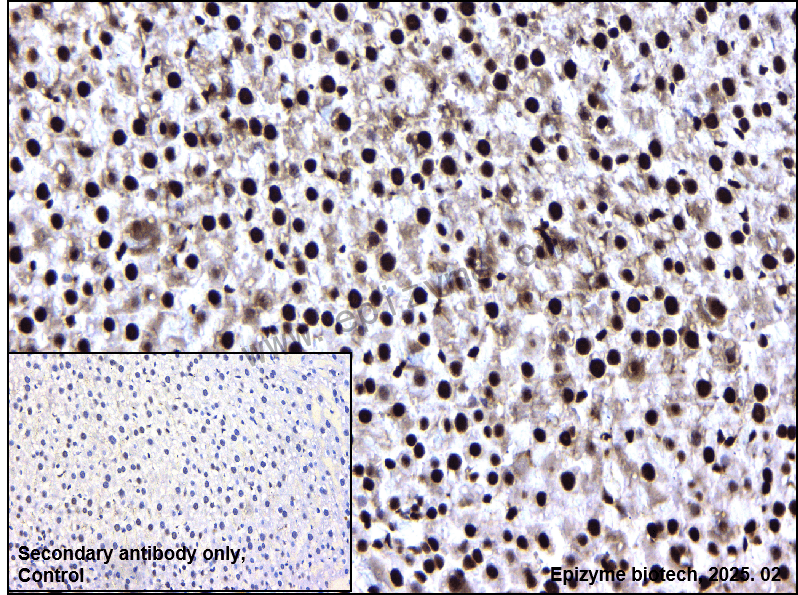 Anti-Phospho-Nucleophosmin (Ser125) Rabbit mAb [34A73C93]