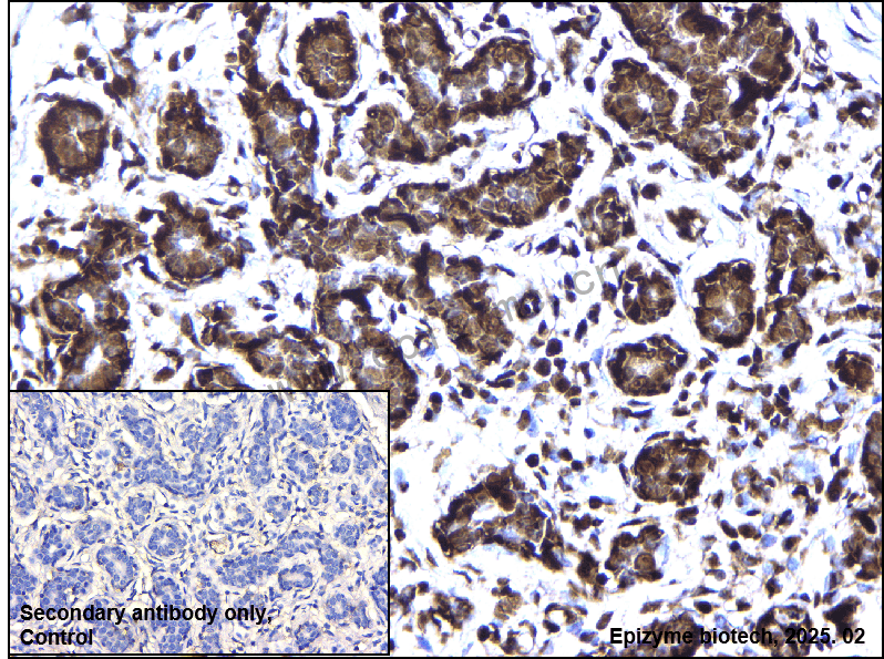 Anti-Phospho-Nucleophosmin (Ser125) Rabbit mAb [34A73C93]