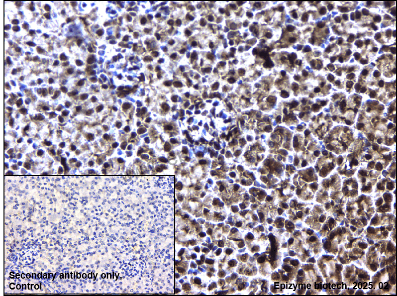 Anti-Phospho-Nucleophosmin (Ser125) Rabbit mAb [34A73C93]