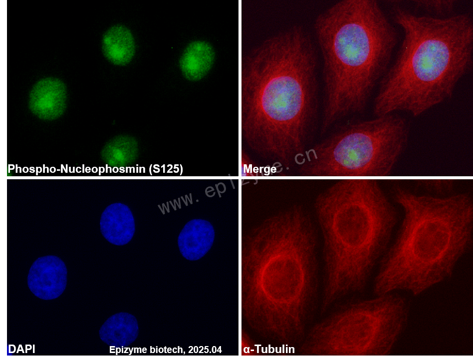 Anti-Phospho-Nucleophosmin (Ser125) Rabbit mAb [34A73C93]