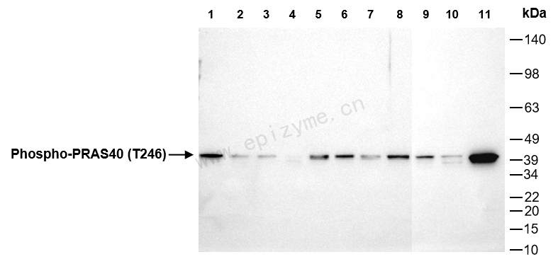 Anti-Phospho-PRAS40 (Thr246) Rabbit mAb [77M70F54]