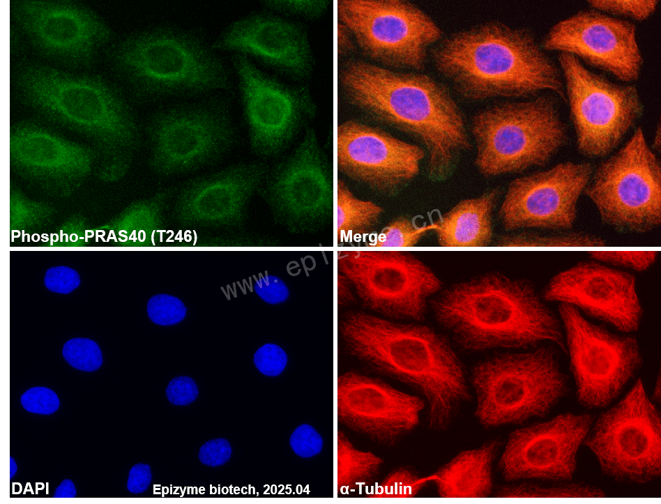 Anti-Phospho-PRAS40 (Thr246) Rabbit mAb [77M70F54]