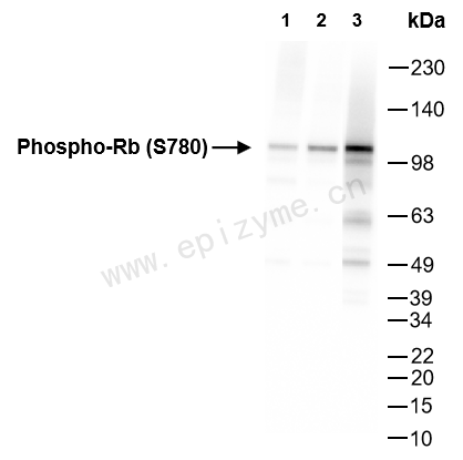 Anti-Phospho-Rb (Ser780) Rabbit mAb [52N81L87]
