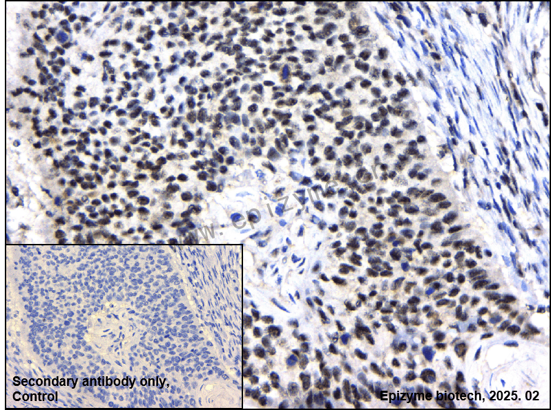 Anti-Phospho-Rb (Ser780) Rabbit mAb [52N81L87]