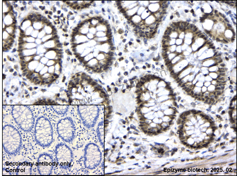 Anti-Phospho-Rb (Ser780) Rabbit mAb [52N81L87]