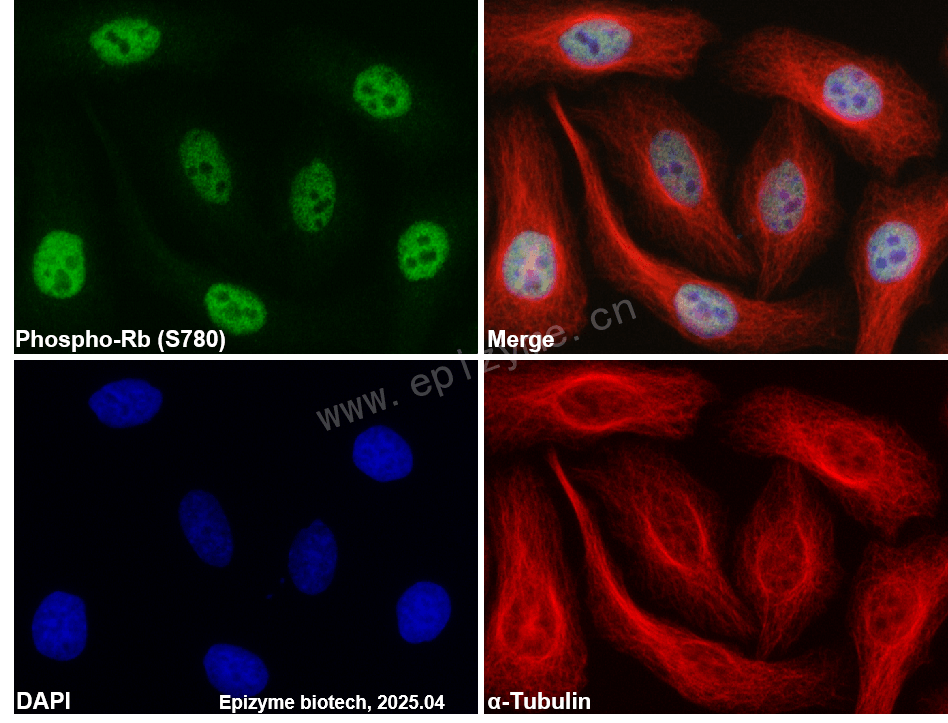 Anti-Phospho-Rb (Ser780) Rabbit mAb [52N81L87]