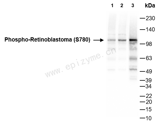 Anti-Phospho-Rb (Ser780) Rabbit mAb [28G08N09]