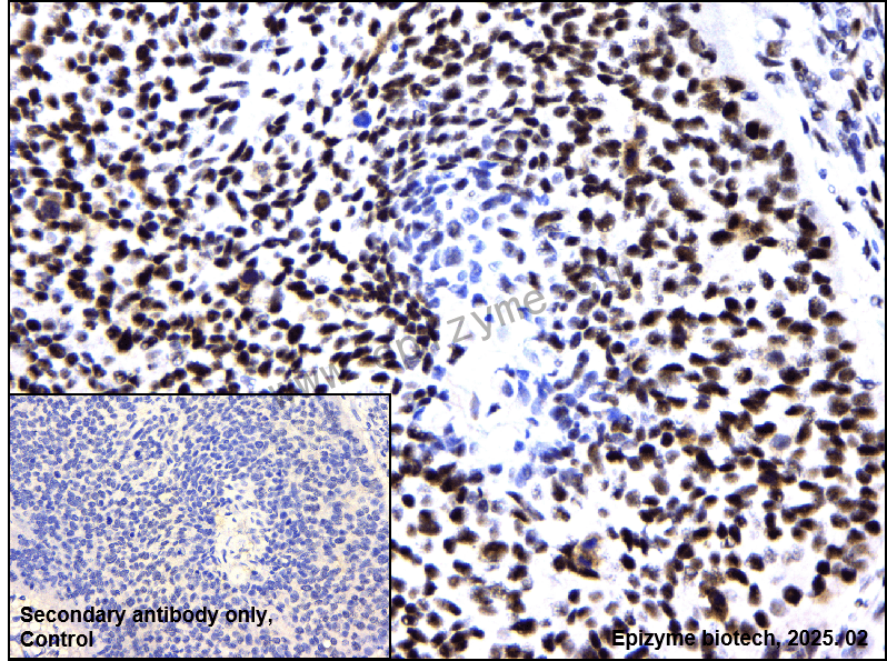 Anti-Phospho-Rb (Ser780) Rabbit mAb [28G08N09]