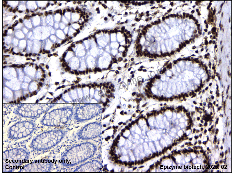Anti-Phospho-Rb (Ser780) Rabbit mAb [28G08N09]