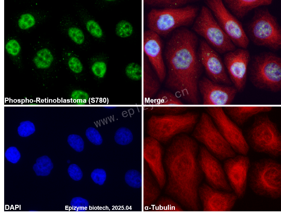 Anti-Phospho-Rb (Ser780) Rabbit mAb [28G08N09]