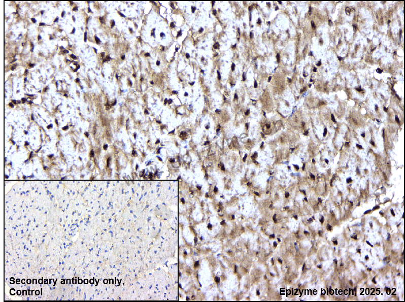Anti-Phospho-STAT3 (Ser727) Rabbit mAb [14I11Q01]