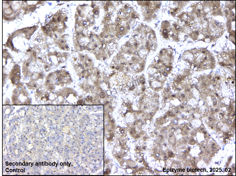 Anti-Phospho-STAT3 (Ser727) Rabbit mAb [14I11Q01]