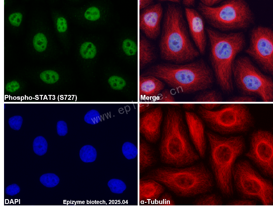 Anti-Phospho-STAT3 (Ser727) Rabbit mAb [14I11Q01]
