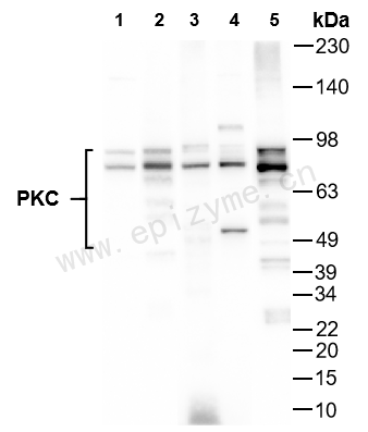 Anti-PKC Rabbit mAb [48F90H25]