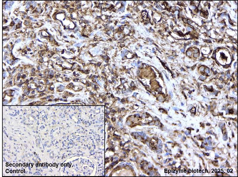 Anti-PKC Rabbit mAb [48F90H25]