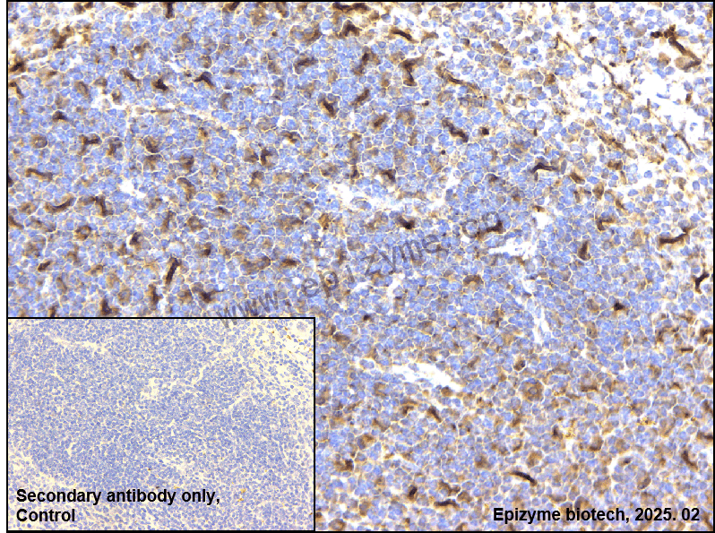 Anti-PKC Rabbit mAb [48F90H25]