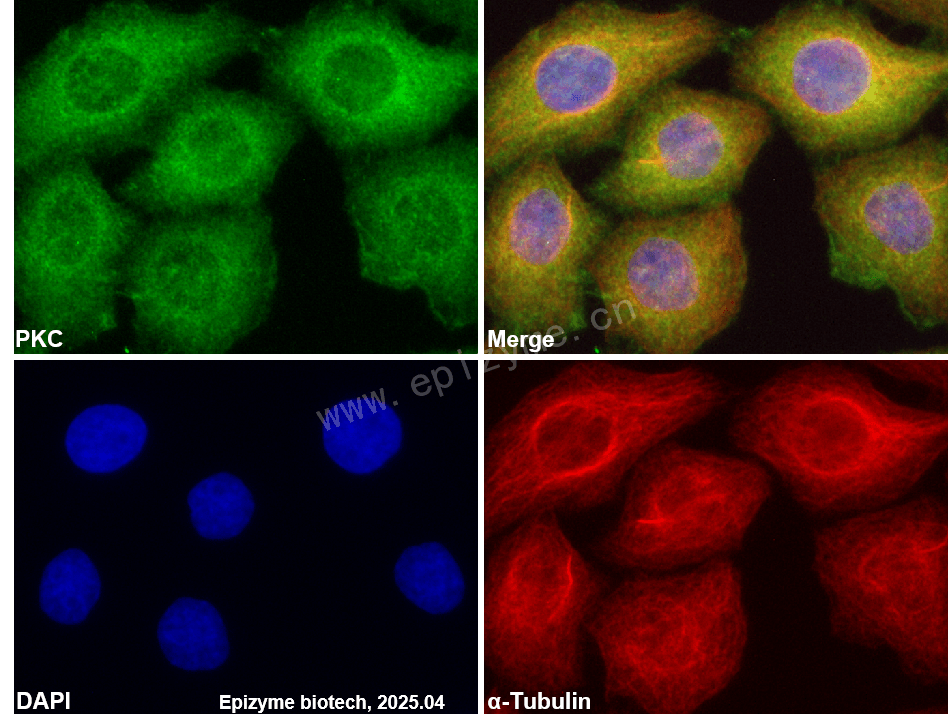 Anti-PKC Rabbit mAb [48F90H25]