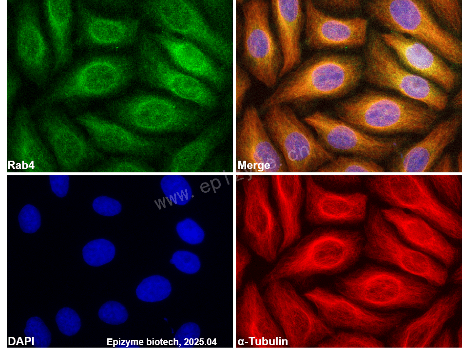 Anti-Rab4 Rabbit mAb [42R09G23]