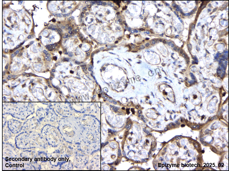 Anti-TNF Receptor II Rabbit mAb [78J39A45]