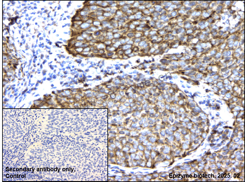 Anti-TNF Receptor II Rabbit mAb [78J39A45]